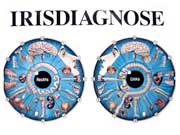 Iris-Diagnose 1